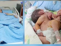 Orangtua Bayi Kembar Siam Dempet Dada di RSUP Adam Malik Medan Mohon Bantuan 