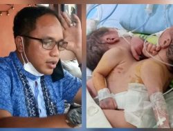 Bupati Batu Bara Tugaskan Tim Kesehatan Bertolak ke RSUP H Adam Malik Pantau Kondisi Bayi Kembar Siam